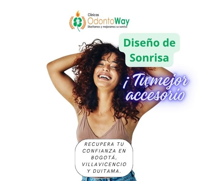 Precio de diseño de sonrisa con carillas de porcelana y blanqueamiento dental en OdontoWay Bogotá