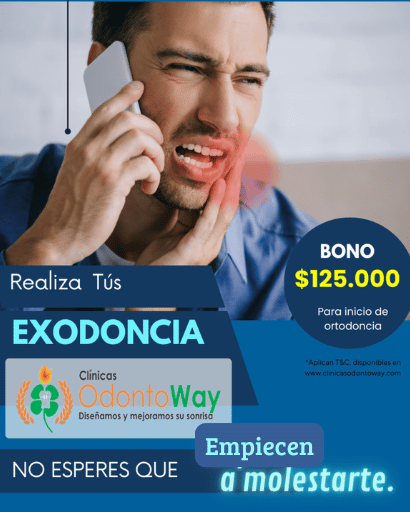 Exodoncia Cordales precio